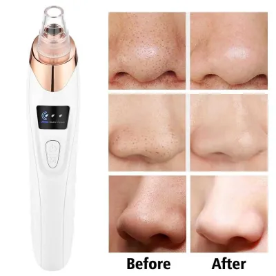 Derma Suction White Rechargeable – side view